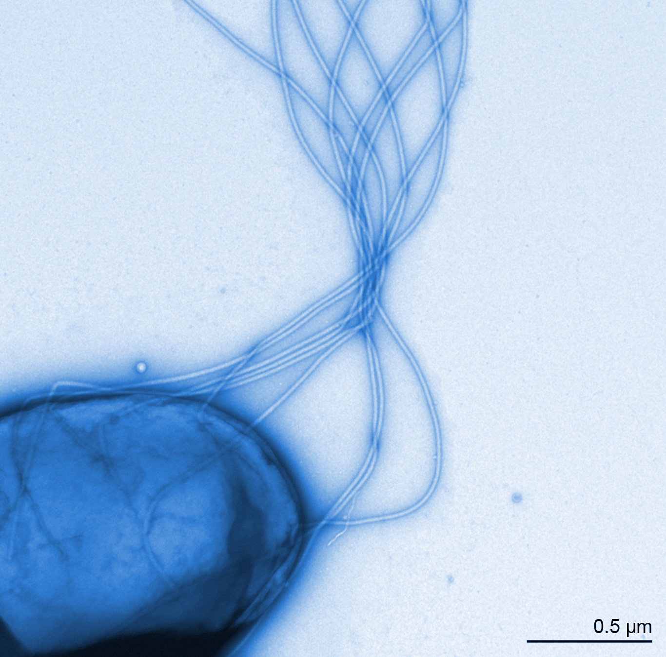 Sal typhimurium a blau klein