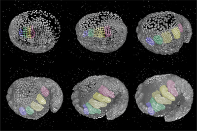 3D reconstructions of an embryo from a lateral view and the head on the left side.