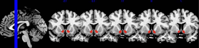 brain graphics